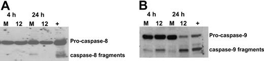 Figure 4. OSU03012 induces activation of intrinsic pathway of apoptosis, as shown by activation of caspase-9 but not caspase-8. (A) OSU03012 induces activation of the intrinsic pathway of apoptosis. Protein lysates from cells treated for 4 and 24 hours with 10 μM OSU03012 were probed for caspase-8 by immunoblot (M indicates media; 12, 10μM OSU0312). Positive control is lysate from irradiated Jurkat cells. Data are representative of 8 patients. (B) Protein lysates from cells treated for 4 and 24 hours with 10 μM OSU03012 were probed for caspase-9 by immunoblot (M indicates media; 12, 10 μM OSU0312). Positive control is lysate from irradiated Jurkat cells. Data are representative of 8 patients.