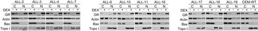 Figure 4. Subcellular fractionation to detect nuclear translocation of GR protein in xenograft cells. Nuclear translocation of GR protein was confirmed in our entire panel of xenografts by subcellular fractionation followed by immunoblot analysis. Xenograft cells were retrieved from cryostorage, exposed to dexamethasone (1 μM, 5 hours), and subjected to subcellular fractionation. Equal amounts of protein (30 μg) from cytoplasmic (C) and nuclear (N) fractions were separated by SDS-PAGE. Membranes were probed with antibodies against GR, actin (loading control), Bax (cytoplasmic control), and topo I (nuclear control).