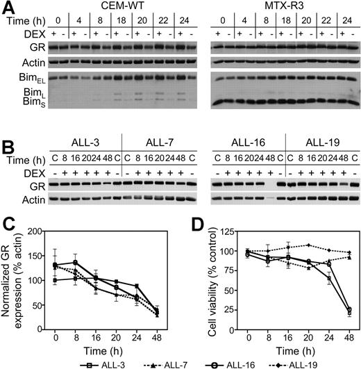 Figure 5. Time course of GR and Bim protein expression in CEM-WT and MTX-R3 cells and changes in GR expression and effects on cell viability in xenograft cells exposed to dexamethasone. (A) CEM-WT and MTX-R3 cells were exposed to dexamethasone (1 μM) and harvested at the indicated time points. Total cellular protein (75 μg) was separated by SDS-PAGE and immunoblotted for GR, actin, and Bim protein expression. Data shown are representative of 2 independent experiments. (B-D) Xenograft cells were retrieved from cryostorage and exposed to dexamethasone (1 μM), and whole cell lysates were prepared at appropriate time points thereafter (0, 8, 16, 20, 24, and 48 hours). (B) Total cellular protein (50 μg) was separated by SDS-PAGE and immunoblotted for GR and actin. C indicates solvent-treated controls. (C) Quantitative data showing GR down-regulation with respect to actin in all 4 xenografts. (D) Cell viability was assessed by trypan blue exclusion at each time point. □ represents ALL-3; ▴, ALL-7; ○, ALL-16; and , ALL-19. In panels C and D each data point represents the mean ± SEM of 3 independent experiments.