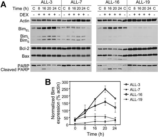 Figure 6. Effects of dexamethasone on expression of Bcl-2 family members and PARP cleavage in xenografts ALL-3, ALL-7, ALL-16, and ALL-19. Xenograft cells were exposed to dexamethasone (1 μM) as indicated in the legend to Figure 5. (A) Total cellular protein (50 μg) was separated by SDS-PAGE and immunoblotted for actin, Bim, Bcl-2, Bax, and PARP. C indicates solvent-treated controls. (B) Quantified expression of the 3 major isoforms of Bim normalized as a percentage of actin controls. Symbols indicate same information as in Figure 5D. Data presented are the mean ± SEM of 3 independent experiments.