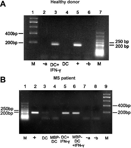 Figure 2. Expression of IDO-specific transcripts in nonadherent CD123+/CCR6+ DCs from healthy donors and MS patients before and after treatment with IFN-γ. Immature DCs (iDCs) obtained from healthy donors (A) or MS patients with or without MBP loading (B) were cultured overnight with medium containing maturation factors, supplemented or not with IFN-γ. Total RNA was isolated and reverse transcribed into cDNA. PCR was performed using IDO-specific primers, and the products were analyzed by agarose gel electrophoresis. The positive control (+) consisted of material extracted from IDO transgene expressing 293 cells, whereas negative control “a” (-a) was water instead of RNA for reverse transcription and negative control “b” (-b) was water instead of cDNA template for PCR; M indicates DNA molecular marker. One representative example for healthy donors and MS patients is shown. A faint IDO band occurred in 2 of 9 tested DCs.