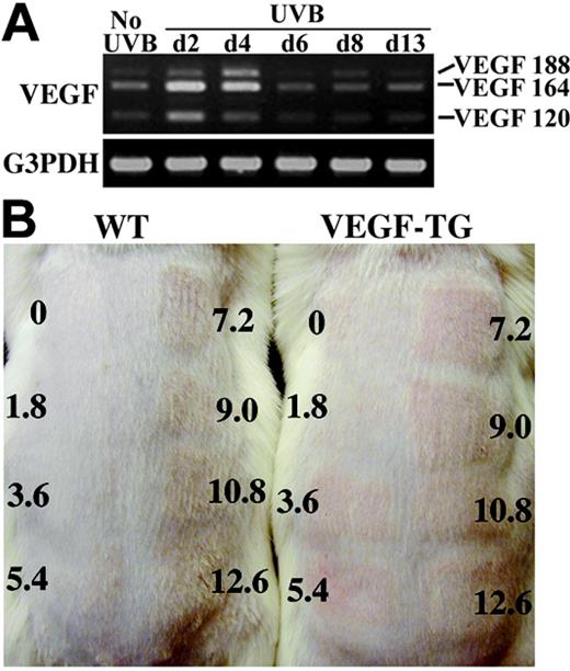 Figure 1. Enhanced photosensitivity in VEGF164 transgenic mice. (A) VEGF164 is the most strongly expressed VEGF isoform in healthy skin compared with moderate expression of VEGF120 and VEGF188, as studied by reverse transcription–polymerase chain reaction (RT-PCR). Expression of all VEGF isoforms was induced at 2 and 4 days after exposure to a single dose of 200 mJ UVB, but VEGF164 was the most strongly expressed isoform at all time points studied. VEGF mRNA expression levels returned to preirradiation levels 8 days after UVB irradiation. (B) Dorsal skin was exposed to graded doses of a single UVB irradiation, ranging from 1.8 × 10-2 J/cm2 to 1.26 × 10-1 J/cm2 or to sham irradiation. In wild-type (WT; n = 5) mice, we found an MED of 7.2 × 102 J/cm2, whereas VEGF-overexpressing mice (VEGF-TG; n = 5) had an MED of 3.6 × 10-2 J/cm2. MED was determined 48 hours after UVB irradiation.