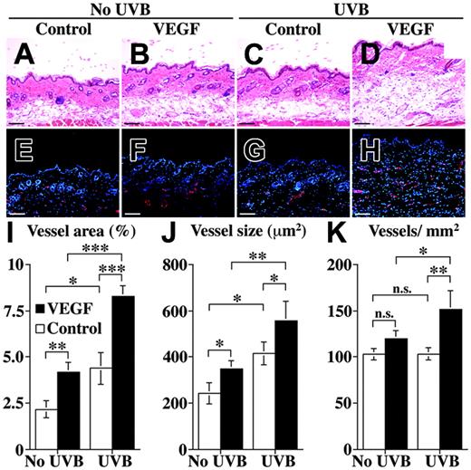 Figure 3. Implantation of VEGF-releasing pellets enhances UVB-induced cutaneous angiogenesis in wild-type mice. Mice were subcutaneously implanted with control or VEGF165 slow-releasing pellets, followed by irradiation with a single UVB dose of 5.4 × 10-2 J/cm2 after 5 days. Histologic analyses revealed marked tissue edema in mice that underwent implantation with VEGF-releasing pellets after 2 days (D) but only minor edema in sham-irradiated mice bearing VEGF-releasing pellets (B) and in UVB-irradiated mice bearing control pellets (C). No major changes were seen in sham-irradiated mice bearing control pellets (A). CD31 stains revealed pronounced neovascularization and vessel enlargement in mice bearing VEGF pellets after UVB irradiation (H), whereas less pronounced vascular enlargement was found in sham-irradiated mice with VEGF pellets (F) and in UVB-irradiated mice bearing control pellets (G). No major vascular changes were observed in sham-irradiated mice that underwent implantation with control pellets (E). Nuclei are labeled blue (Hoechst stain). Scale bars, 200 μm. A Plan Fluor 20 × objective with an aperture of 0.50 was used for panels A-H. Morphometric analyses of CD31-stained skin sections confirmed a significant increase in the cutaneous area covered by vessels (I), average vessel size (J), and average vessel density (K) in UVB-irradiated mice that underwent implantation with VEGF-releasing-pellets (▪) compared with UVB-irradiated mice that underwent implantation with control pellets (□). Sham-irradiated mice that underwent implantation with VEGF-releasing pellets showed a significant increase in the average cutaneous area covered by vessels (I) and vessel size (J), but not vessel density (K), compared with mice bearing control pellets. ***P < .001; **P < .01; *P < .05. n.s. indicates not significant. Data represent mean values ± SD.