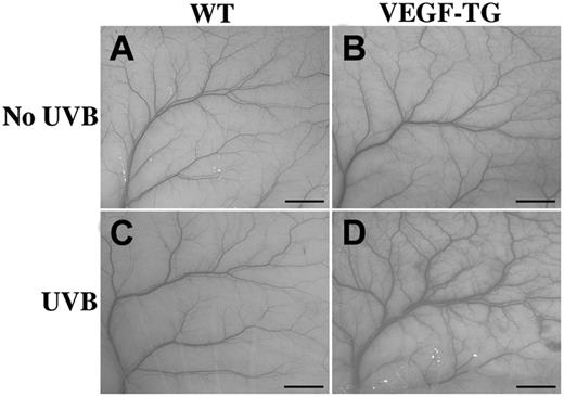 Figure 6. Increased vascularization in the skin of VEGF-overexpressing mice after long-term UVB irradiation. Compared with their wild-type littermates (A), VEGF-overexpressing mice that did not undergo irradiation had a slight increase in cutaneous vascularization (B). No changes were observed in wild-type mice (C) after long-term UVB irradiation, but increased cutaneous vascularization, with prominent enlargement of blood vessels, was observed after chronic UVB treatment of the skin of VEGF-overexpressing mice (D). Scale bars, 3 mm. Images were taken using a Nikon Coolpix 950 digital camera.