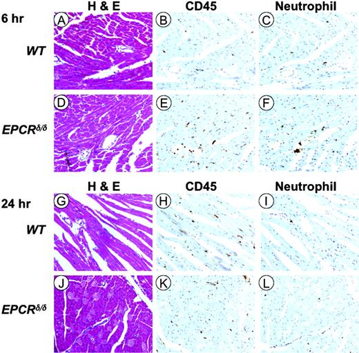 Figure 4. Histochemical and immunohistochemical analysis of murine cardiac tissue after LPS administration. H&E staining of WT (A) and EPCRδ/δ (D) mouse heart sections 6 hours after LPS administration. (B,E) Anti-CD45 immunostaining of serial heart sections of WT and EPCRδ/δ mice, respectively, 6 hours after LPS administration. (C,F) Antineutrophil protein immunostaining of serial heart sections of WT and EPCRδ/δ mice, respectively, 6 hours after LPS administration. (G-L) Similar H&E (G,J), anti-CD45 (H,K), and antineutrophil protein (I,L) staining and immunostaining of WT and EPCRδ/δ mice, respectively, at 24 hours after LPS treatment. A Nikon Eclipse E600 light microscope (Nikon, Melville, NY) with a Nikon Plan Fluor objective (magnification, × 20; numerical aperture, 0.5). Images were captured with a SPOT 2 slider (model 1.4.0) camera (Diagnostic Instruments, Sterling Heights, MI) using SPOT software. The images were transferred to Adobe Photoshop 7.0 (Adobe, San Jose, CA) for final reproduction.