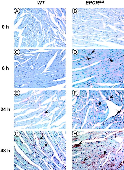Figure 5. Antifibrin(ogen) immunostaining of heart sections at various times after LPS administration for WT and EPCRδ/δ mice, respectively. (A-B) WT and EPCRδ/δ control heart tissue (time = 0), respectively; (C-D), WT and EPCRδ/δ heart tissue, respectively, at 6 hours after LPS; (E-F), WT and EPCRδ/δ heart tissue, respectively, at 24 hours after LPS; (G-H), WT and EPCRδ/δ mice, respectively, at 48 hours after LPS. Microscopy was performed as described in Figure 4.