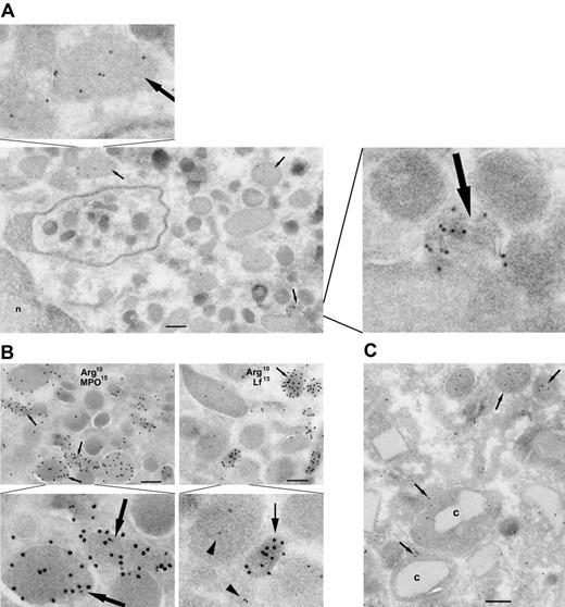 Figure 5. Localization of arginase I in human resting PMNs analyzed by immunogold electron microscopy. (A) Cryosections of PMNs were immunogold labeled with polyclonal rabbit anti–arginase I antibody (10 nm gold). Arginase I localized to the matrix of granules (arrows). (B) Arginase I colocalizes with MPO. To characterize the arginase I+ granules, PMNs were double-labeled with anti–arginase I (10 nm gold) and anti-MPO or anti-Lf (both 15 nm gold), respectively. After double-labeling for MPO, almost all arginase I+ granules were also MPO+ (arrows), whereas in most granules there was no colocalization of arginase I (arrowheads) and lactoferrin (thin arrow). (C) Localization of arginase I in human eosinophils. In the same cryosections as above, some eosinophils were present. Arginase I is again found in the matrix of granules with (c) or without crystalloid (arrows). Bars are 200 nm.