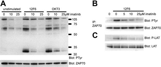 Figure 6. Imatinib inhibits signal transduction through TCR. Jurkat T cells were stimulated with 12F6 (100 ng/mL) or OKT3 (mouse ascites 1:250) for 5 minutes in the presence or absence of imatinib. (A) Whole-cell lysates were analyzed by Western blotting for tyrosine phosphorylation (PTyr). To control for protein loading, the antiphosphotyrosine antibody was inactivated and the membrane was reprobed with ZAP70 antibody. (B) ZAP70 was immunoprecipitated from 500 μg whole-cell lysate. Immunoblotting was performed with anti-ZAP70 or antiphosphotyrosine antibodies. (C) Whole-cell lysates were analyzed for LAT activation by immunoblotting for phosphorylated LAT (Tyr 171 and Tyr 191) and for total LAT as indicated.
