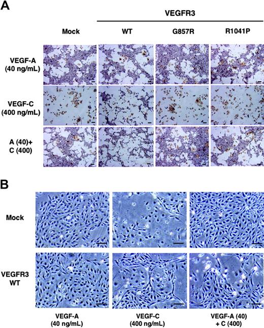 Figure 2. Serum-free culture of sorted VEGFR2+ cells expressing VEGFR3 and its kinase-negative mutants. (A) VEGFR2+ cells transfected with mock, VEGFR3(WT), and its kinase-negative mutant cDNAs were cultured in SFO3 serum-free medium with VEGF-A (40 ng/mL), VEGF-C (400 ng/mL), or VEGF-A and VEGF-C. After 2 days, cells were doubly stained with anti–PECAM-1 (purple) and anti-SMA (brown) antibodies. (B) Differentiated cells were observed by phasecontrast microscopy. Scale bar, 100 μm.