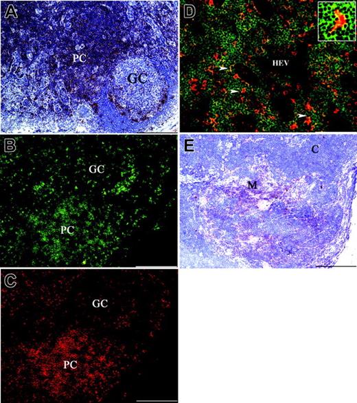 Figure 3. Expression of SIRPβ2 in lymph nodes and thymus. (A) SIRPβ2 is mainly expressed in the paracortical area (PC) of lymph nodes with only sparse positive cells in the mantle and in the germinal center (GC) of B-cell follicles. (B-C) Two-color immunofluorescence of lymph nodes with mAbs anti-SIRPβ2 (B) (green) and anti-CD3 (red) (C). The large majority of lymph node SIRPβ2+ cells, including those found in the germinal center, coexpress CD3. (D) Two-color immunofluorescence of a lymph node shows diffuse expression of SIRPβ2 in lymphocytes of the T-cell area (green), clustered around scattered CD11c+ DCs (red). Cell-cell interactions between SIRPβ2+ lymphocytes and CD11c+ DCs appear as yellow dots (arrowheads and insert). HEV indicates high endothelial venule. (E) SIRPβ2+ lymphocytes are numerous in the thymic medulla (M) and scattered in the cortex (C). SIRPβ2 was detected by indirect immunoperoxidase technique and counterstaining with Meyer hematoxylin (A,E). Scale bars are 200 μm (A-C,E) and 100 μm (D). Magnification is 100 × (A-C,E) and 200 × (D).