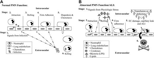 Figure 3. Normal and abnormal neutrophil physiology. (A) Normal PMN emigration from the vasculature to the site of infection or inflammation in the tissues. In response to an infection (grouped ovals) in the tissues, inflammatory signals (stage 1, arrows) diffuse through the tissues to the vasculature and activate the vascular endothelium, causing release of chemokines (stage 2, 4-pointed stars), which attract PMNs to the endothelial surface (stages 3-4).20,102-104 Attraction is followed by selectin-mediated PMN rolling (stage 3) and β2-integrin/ICAM-1–mediated firm adhesion of PMNs to ECs (stage 4).20,102-104 These PMNs, which have undergone a change from a nonadhesive to an adhesive phenotype, are now primed (stage 4).20 Priming of PMNs enhances the microbicidal function of PMNs to a subsequent stimulus and changes the activity of PMNs such that stimuli that normally do not cause the activation of quiescent neutrophils are able to activate primed PMNs.20,88 It is important to note that priming is part of the orderly process of PMN transmigration to the tissues. Although there are benefits to enhanced PMN function, including efficient destruction of pathogens, it is clear priming may be detrimental to the host and may lead to PMN-mediated organ injury, especially ARDS.20 The PMNs then pass by diapedesis through the endothelial layer (stage 5), orient by chemotaxis to the site of infection (stage 5), and phagocytize (stage 6) and destroy the bacterial invaders (stage 6).20,102-104 (B) PMN-mediated tissue injury. If the orderly process of PMN transmigration is altered by a stimulus coming from the intravascular space (4-pointed stars, crosses, triangles) rather than the tissues, these intravascular stimuli activate vascular ECs (arrows) and cause attraction (stage 2), selectin-mediated rolling (stage 3), firm adhesion through the ICAM-1/β2-integrin interaction (stage 4), and priming of PMNs (stage 4).20 However, because there are no signals to cause diapedesis and PMN chemotaxis into the tissues, the PMNs become sequestered in the microvasculature.20 These primed, hyperreactive leukocytes may be activated by stimuli (stage 5, large triangle with diamonds) that normally have no effect, including antibodies directed against specific leukocyte antigens or the lipids that accumulate during routine storage of cellular blood components.20 Activation of these adherent PMNs causes endothelial damage (stage 5, ECs with lines) with lines, capillary leak (large arrow, stage 6), and organ injury.20