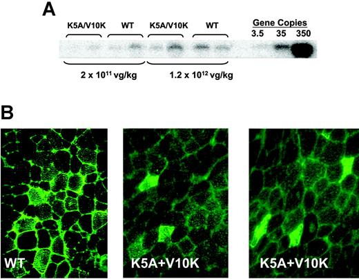 Figure 3. Vector gene copy number and histochemical staining of skeletal muscle of C57Bl/6 Rag-1-deficient mice 14 weeks following injection of AAV vectors encoding F.IX-WT or variant K5A/V10K. (A) Southern blot analysis of genomic DNA extracted from murine skeletal muscle injected with AAV-F.IX-WT or F.IX-K5A/V10K at the doses indicated. Copy number standards were prepared by adding 3.5, 35, and 350 copies of plasmid per murine diploid genomes. (B) Immunofluorescent staining for human factor IX in tibialis anterior muscle. Animals were injected in the hind limbs with 1.2 × 1012 vg/kg AAV-F.IX-WT or K5A/V10K divided equally among 6 injection sites. Representative sections from the injected muscle are shown. Excitation of fluorescence tags revealed both intracellular and extracellular signals in muscle injected with F.IX-WT, but markedly reduced extracellular signals in muscle injected with F.IX-K5A/V10K, while intracellular signals are clearly detectable. Original magnifications, × 200.