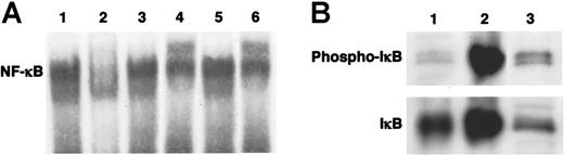 Figure 1. Spontaneous activation of NF-κB in HMC-1 cells. (A) NF-κB binding activity in nuclear extract obtained from HMC-1 cells was detected through EMSA (lane 1). Unlabeled consensus oligonucleotides (lane 2), but not mutant oligonucleotides (lane 3), competed the positive reaction. Antibodies against the p65 subunit (lane 4) and the p50 subunit (lane 6) of NF-κB shifted an electric mobility of the band to the upper position. On the other hand, anti-cRel antibody did not alter the mobility (lane 5). (B) Phosphorylation of IκBα in HMC-1 cells was detected by Western blotting (lane 1, HeLa cells; lane 2, HeLa cells stimulated with TNF-α; lane 3, HMC-1 cells).