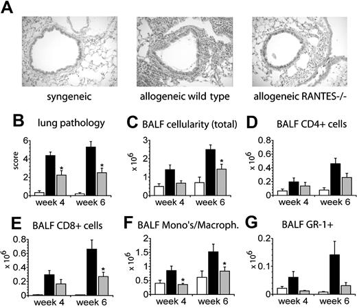 Figure 3. Allogeneic SCT with RANTES-deficient donor cells results in significantly decreased IPS severity. Lethally irradiated B6D2F1 mice received SCT from either syngeneic B6D2F1 (□), or allogeneic B6 wild-type (▪) or B6 RANTES-/- (▦) donors. Animals that received transplants were analyzed at 4 and 6 weeks after SCT. (A) Photomicrographs of lung tissue 6 weeks after SCT (HE; × 200). (B) Lung injury as assessed by a semiquantitative scoring index at 4 and 6 weeks after SCT. Data are presented as mean ± SEM and are combined from 2 comparable experiments at week 6 (n = 9 to 11 per group; *P < .01) or from 1 experiment at week 4 (n = 4-8 per group; *P < .05). BALF cellularity (C), CD4+ T cells (D), CD8+ T cells (E), monocytes/macrophages (F), and GR-1+ cells (G) 4 and 6 weeks after SCT. Data are expressed as mean ± SEM and are either combined from 2 comparable experiments (n = 9 to 11 per group) at week 6 or from 1 experiment (n = 4 to 8 per group) at week 4; *P < .05.