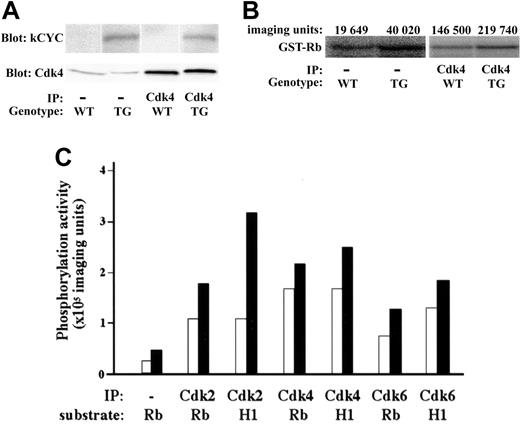 Figure 2. Functional kCYC protein expression in lungs of kCYC+/- transgenic mice. (A) Western blotting using total protein and immunoprecipitated protein (using anti-Cdk4 antibodies) isolated from lung tissue. IP indicates immunoprecipitation; TG, kCYC+/- mice. (B) Kinase assay using lung tissue and GST-Rb as a substrate. (C) Quantitative summary of kinase assays. WT (□) and TG (▪) mice (n = 2). H1 indicates histone H1.