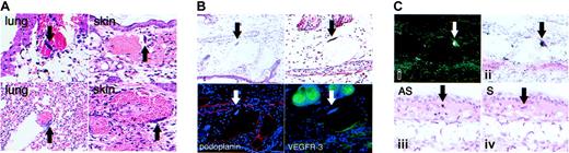 Figure 5. Karyomegaly and kCYC mRNA positivity in nuclei of cells lining dilated vascular structures that express podoplanin and VEGFR-3 in kCYC+/- transgenic mice. (A) H and E staining of TG lung (left) and tagged TG ear skin (right) showing karyomegaly of endothelial cells (arrows). These cells were never observed in tissue obtained from WT mice (data not shown) (× 100-200). (B) Karyomegaly of endothelial cells (arrows and blue DAPI stain) lining vascular structures in tagged TG ear skin that contain erythrocytes and express podoplanin (red) and VEGFR-3 (green) (× 200). (C) In situ hybridizations for kCYC mRNA in tagged TG ear skin of 2 different mice both showing positive antisense signals in karyomegalic cells that line dilated vascular structures and contain erythrocytes. Dark field (i) and bright field (ii) from a single mouse processed with 35S-radiolabeled antisense probes for 7 days. Lower panels show serial sections of tissue from a second mouse processed with 35S-radiolabeled antisense (AS, left) or sense (S, right) control probes. Signals above background were never observed in tissues obtained from WT mice (data not shown) (× 200).