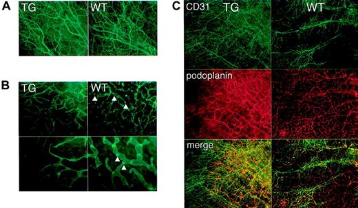 Figure 6. Abnormal lymphatic architecture in skin of kCYC+/- transgenic mice. Whole-mount staining of nontagged TG (left panels) and WT (right panels) ear skin for CD31 (A,C) and podoplanin (B-C) showing normal blood vessel number and architecture (A,C) and abnormal lymphatic architecture (B-C) in TG mice, that is, lymphatics of TG mice are lacking valvelike structures (arrowheads) (× 200-400).