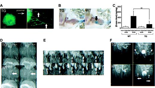 Figure 7. Abnormal lymphatic function in kCYC+/- transgenic mice. (A) Fluorescence microscopy of whole-mounted nontagged ear 5 minutes following intradermal injection of FITC-dextran showing lack of lymphatic drainage in TG mice (left); lymphatics (arrows) are easily visualized in WT mice (right) (× 200). (B) Evans blue dye accumulation in popliteal lymph node (arrow) 10 minutes following dermal injection into footpad is not detected in TG mice (left), whereas the popliteal lymph node is easily visualized in WT mice (right). (C) Quantification (mean ± SD) of Evans blue dye content in popliteal lymph nodes after dermal injection into footpad (n = 8). MRI lymphangiograms showing (D) no thoracic duct enhancement (arrows) 5 and 45 minutes following injection of the dendrimer G8 bilaterally into the midphalangeal areas of TG mice (top row), whereas enhancement is observed in WT mice as early as 5 minutes following injection of G8 (bottom row); (E) delayed detection of the right external iliac node (arrows) in TG (top row), compared to WT (bottom row), mice following injection of the dendrimer G8 bilaterally into the midphalangeal areas; and (F) poor visualization of popliteal lymph nodes (asterisks) and evidence of backflow (arrowheads) in superficial lymphatics of the lower extremities (arrows) in TG (upper), but not WT (lower), mice 15 minutes following G8 injection bilaterally into the midphalangeal areas.