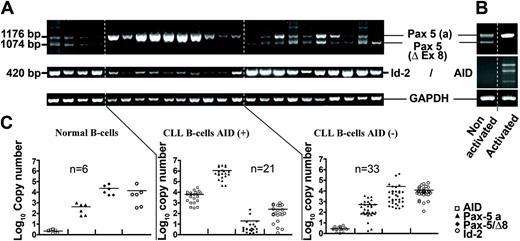 Figure 2. Expression profile and quantification of Pax-5, AID, and Id-2 transcripts in normal and CLL B cells. (A) Semiquantitative gene-specific RT-PCRs of Pax-5a, Pax-5/Δ-Ex8, and Id-2 transcripts in normal B cells and in CLL B cells with or without expression of AID. GAPDH was used as cDNA control (B) mRNA transcript amplifications of the Pax-5 and AID genes before and after CD40+IL-4 stimulation in a representative normal healthy donor. (C) Quantification of AID (□), Pax-5a (▴), Pax-5/Δ-Ex8 (), and Id-2 expression transcripts (○) by QRT-PCR normalized to GAPDH mRNA. The gene copy number was calculated with a standard curve generated from serially diluted plasmids containing an amplified fragment of each gene. n = number of study samples.