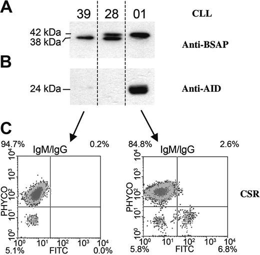Figure 3. Evaluation of the CSR process together with BSAP, Pax-5/Δ-Ex8, and AID translation in CLL B cells. Western blot analysis of BSAP, Pax-5/Δ-Ex8 spliced variant (A), and AID protein (B) were detected with specific antibodies from 3 representative patients (nos. 39, 28, and 01). Relative molecular weight is indicated in kilodaltons (kDa). (C) Flow cytometry analysis shows IgM and IgG isotypes in B-CLL lymphocytes from patients 01 and 39, respectively. Histograms show the percentage of cells expressing IgM, IgG, or both IgM/IgG.
