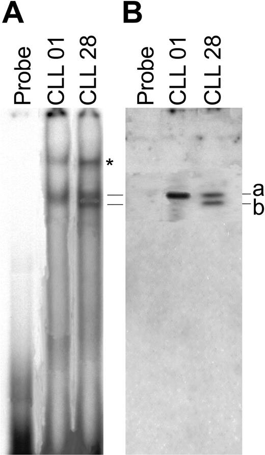 Figure 6. Binding of Pax-5 and spliced variant Pax-5/Δ-Ex8 to the AID promoter. (A) EMSA of nuclear extracts of CLL B cells from 2 patients was performed. The asterisk indicates a nonspecific band. Oligoprobes containing the P3 promoter region of the AID gene without nuclear extracts was used as control. (B) Western blot analysis with anti–Pax-5 (C-20) goat polyclonal IgG was performed to assess the specificity of the complex detected in EMSA. Solid lines (bands a and b) indicate the Pax-5a– and Pax-5/Δ-Ex8–containing complexes, respectively, in both assays (EMSA and Western blot). One of 3 independent experiments is shown.