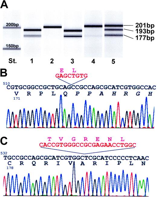 Figure 2. Mutational analysis of the SOCS-1 gene. (A) Gel view of a DNA 1000 LabChip biosizing assay. SOCS-1 mRNA–specific PCR products from RT-PCR assays on RNA derived from MedB-1 cells (lane 1) and autologous fibroblasts (lane 2). Lanes 3, 4, and 5 represent specific SOCS-1 gene fragments amplified by PCR on DNA separated from MedB-1 cells (lane 3), autologous fibroblasts (lane 4), and tumor tissue (lane 5). Wild-type SOCS-1 sequence appeared as the 201-bp band. St, standard 200 bp and 150 bp, respectively. (B) Detailed sequencing chromatogram of the 193-bp PCR product indicates an 8-bp deletion (red sequence) causing a reading frame shift (altered protein sequence is given in italics). (C) Detailed sequencing chromatogram of the 177 bp PCR product indicating an inframe deletion of 24 nucleotides (red sequence) and loss of 7 amino acids. DNA and protein sequences are numbered relative to the start as 1.