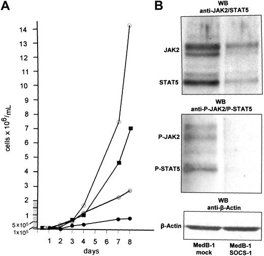 Figure 4. Effect of wt SOCS-1 transfection on MedB-1 cells. (A) MedB-1 cell proliferation assay. The cell densities at the beginning of the experiments were adjusted to 1 × 105 cells/mL. Cell numbers were determined in triplicates every day in 50 μL cell suspension from MedB-1 cells cultured in complete medium (○), in medium supplemented with 20 μM Tyrphostin AG490 (), and in MedB-1 cells transfected with wt SOCS-1 plasmid (•) and mock plasmid (▪). (B) Western blot analysis of wt SOCS-1–transfected MedB-1 cells. Twenty-four hours after transfection with a mock plasmid (lane 1) and the wt SOCS-1 plasmid (lane 2), proteins were extracted and subjected to Western blot analyses as described; β-actin is shown as loading control. While the content of JAK2 and STAT5 proteins is at comparable levels, phosphorylation is barely detectable in transfectants.