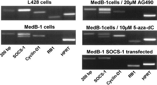 Figure 5. Comparative RT-PCR analysis of SOCS-1, cyclin D1, RB1, and HPRT expression. RT-PCR using specific primer pairs to detect the expression of the indicated genes was performed on RNA extracts derived from MedB-1 cells cultured in complete medium or cultured for 5 days in medium supplemented with 20 μM Tyrphostin AG490 or 10 μM 5-aza-deoxycytosine (5-aza-dC) and on RNA from MedB-1 cells transiently transfected with a SOCS-1 expression plasmid. AG490 slightly decreases cyclin D1 expression, and 5-aza-dC induces RB1 expression. Wild-type SOCS-1 induces RB1 expression and abolishes cyclin D1 transcription.