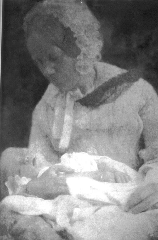 Figure 1. An 1857 photograph of 48-year-old Emma Darwin and her youngest child, Charles Waring, taken by 17-year-old William with a camera he received for his birthday. Although not diagnostic, the baby's facial features are consistent with a diagnosis of Down syndrome, and advanced maternal age and the notes taken by Charles also support this diagnosis. Copyright English Heritage, used with permission.
