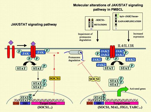 The JAK/STAT signaling pathway and its main oncogenic alterations in primary mediastinal large B-cell lymphoma. On the left, the JAK tyrosine kinases are activated by cytokines and phosphorylate the signal transducers and activators of transcription (STATs), which subsequently dimerize and translocate to the nucleus where they promote the transcription of target genes. One of these genes is the suppressor of cytokine signaling 1 (SOCS1) that inhibits the pathway in an autoregulatory loop by binding to the phosphorylated JAK and promoting its degradation through the proteasome pathway. On the right, PMBL carries 2 putative oncogenic aberrations in the JAK2/STAT pathway. JAK2 is amplified and overexpressed and the protein is phosphorylated. Prolonged JAK2 half-life is sustained by SOCS1 mutations. Expression profiling of PMBL has detected overexpression of the IL-4/IL-13 receptor, JAK2 and STAT, and several target genes of this pathway.