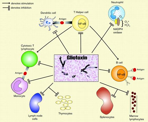 Gliotoxin, a toxin produced by AF, suppresses several key pathways in innate and antigen-specific immunity. Gliotoxin likely suppresses T-cell responses principally by inducing apoptosis of antigen-presenting cells. The center box depicts experimental invasive pulmonary aspergillosis in a mouse (silver stain; original magnification × 400).