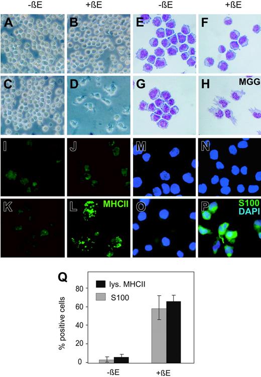Figure 1. Activation of PU.1 in primary myeloblast clones induces DC phenotype. Clonal E26ts21-PUER virus (C-D, G-H, K-L, O-P)– or E26ts21 control virus (A-B, E-F, I-J, M-N)–transformed chicken myeloblasts were cultured for 48 hours either in the absence (-βE; A, C, E, G, I, K, M, O) or presence of 1 μM βE(+βE; B, D, F, H, J, L, N, P). (A-D) Phase contrast micrographs of cell cultures visualized under a Leica DMiL optical microscope equipped with a 40×/0.5 objective lens (Leica, Wetzlar, Germany). (E-H) May-Grünwald-Giemsa staining (MGG) of cytocentrifuged cells (shown at original magnification, ×40). (I-L) Immunofluorescence detection of MHCII with an FITC-conjugated secondary antibody. Images were viewed under a Leica DMRBE fluorescence microscope equipped with a 40×/1.0 objective lens (Leica) and a Nikon DVM1200 digital camera (Nikon, Champigny sur Marne, France). Lucia software version 4.61 was used for image processing (Nikon). (M-P) Immunofluorescence detection of S100 with an FITC-conjugated secondary antibody. Nuclei were counterstained with DAPI. (Q) Cells containing MHCII lysosomal vesicles (▪)or staining positive for S100 (▦) were counted for a total of at least 100 cells in 6 independent PUER clones cultured with or without βE.