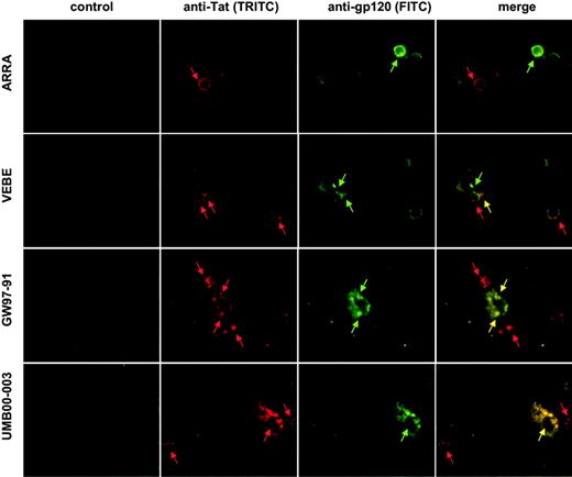 Figure 5. Tat is detectable on the surfaces of both gp120-positive and gp120-negative cells in vivo. Two PBMC samples (ARRA and VEBE) and 2 lymph node biopsies (UMB00-003 and GW97-91) were simultaneously stained with NT3 2D1 IgG1 anti-Tat and CRA3 IgG2a anti-gp120 antibodies, followed by detection with anti-IgG1–TRITC and anti-IgG2a–FITC secondary antibodies. Arrows point at specific staining either for Tat (red), gp120 (green), or colocalization of the 2 proteins (yellow). Control pictures are staining with secondary Ab only.