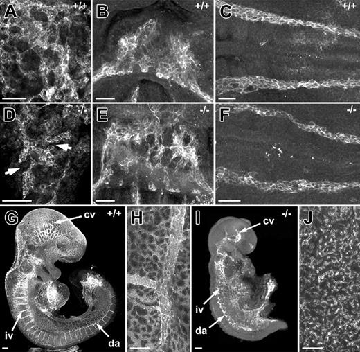 Figure 1. Temporal failure of vasculogenesis in VE-cadherin null embryos. (A,D) High-magnification images of PECAM-immunolabeled allantoides from normal (A) and VE-cadherin null (D) 8.5-dpc embryos. Note that the extent of vascularization is greatly reduced in the VE-cadherin nulls as compared to controls. Arrows in panel D point to discontinuous PECAM+ vessels not apparent in the vascular network of normal allantois explants. (B,E) PECAM-immunolabeled endocardial cells from normal (B) and VE-cadherin null (E) 8.5-dpc embryos. Note the aggregates of PECAM+ cells in the hearts of the VE-cadherin nulls as compared to the continuous layer of PECAM+ cells that comprise the endocardial tube of the normal heart. (C,F) PECAM-immunolabeled dorsal aortae from normal (C) and VE-cadherin null (F) 8.5-dpc embryos. (G,I) PECAM-immunolabeled 9.5-dpc VE-cadherin wild-type (G) and null (I) embryos. Pronounced abnormalities of the dorsal aortae (da), intersomitic vessels (iv), and cranial vessels (cv) are apparent in the 9.5-dpc VE-cadherin null embryo as compared to the normal 9.5-dpc embryo. (H,J) PECAM-immunolabeled yolk sacs of 9.5-dpc VE-cadherin wild-type (H) and null (J) embryos. The VE-cadherin wild-type yolk sac contains large PECAM+ blood vessels and continuous networks of smaller vessels, whereas the yolk sac of the null contains only clusters of PECAM+ cells. Panels A through J are confocal images. Bars equal 100 μm.