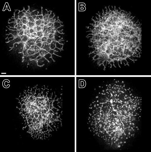 Figure 4. Established vessels formed in long-term cultures of normal 8.5-dpc allantoides exhibit incremental disassembly in response to BV13 treatment. (A-D) Confocal images of PECAM-immunolabeled allantois cultures derived from normal 8.5-dpc embryos. (A) A control explant cultured for 30 hours. (B-D) Explants that were first cultured for 18 hours and then cultured for an additional 2 (B), 6 (C), or 12 hours (D) in the presence of BV13 (24 μg IgG/mL). Alterations in vascular morphogenesis are evident at 6 hours after addition of BV13 (C). By 12 hours after BV13 administration, the now 30-hour-old culture (D), as compared to control (A), shows an almost complete dysmorphogenesis of the blood vessels. Bars equal 100 μm.