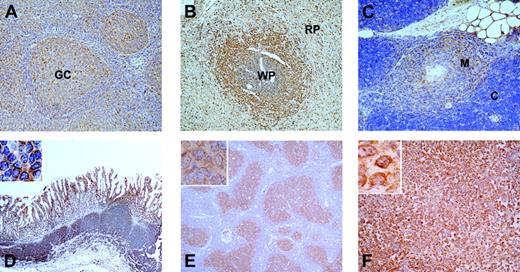 Figure 1. Expression of MALT1 in normal human lymphoid tissues. Sections of normal reactive tonsil (panel A), spleen (panel B), and thymus (panel C) were stained with antibodies against MALT1. The germinal center (GC) of the tonsil, the white pulp (WP) and red pulp (RP) of the spleen, and the medulla (M) and cortex (C) of the thymus are indicated. The same staining was performed with sections of gastric MALT lymphoma (panel D), follicular lymphoma (panel E), and diffuse large B-cell lymphoma (DLBCL; panel F). Images were acquired as described in “Immunohistochemical staining.”