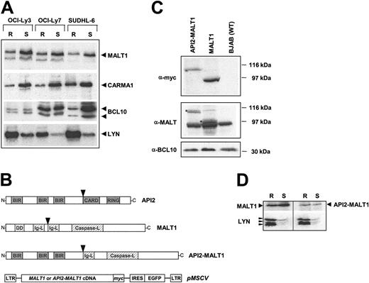 Figure 2. Constitutive expression of MALT1 in lipid rafts of human B-cell lymphoma cells. (A) Western blotting shows MALT1, as well as CARMA1 and BCL10, to be located in both lipid raft (R) and soluble fractions (S) in DLBCL cell lines separated by sucrose gradient centrifugation. Arrowheads mark the band of the expected full-length size for each protein. The origin of the smaller band on the MALT1 blots, not observed in blots from BJAB cells, is uncertain. The multiple bands of BCL10 represent phosphorylation isoforms as they disappear after phosphatase treatment (data not shown). The partitioning of LYN, a B-cell-specific protein of the Src protein kinase family known to be constitutively present in rafts, confirms effective separation of raft and nonraft protein fractions. (B) Structure of C-terminal myc-tagged MALT1 and API2-MALT1 transgenes and pMSCV retroviral vectors used in the study. Arrowheads show positions of the most common breakpoints found in t(11;18) that give rise to the API2-MALT1 fusion gene, which is used for all of the following experiments. (C) Lysates from equivalent cell numbers of pools of BJAB cells transfected with API2-MALT1 or MALT1 were immunoblotted for myc, MALT1, and BCL10. The exogenous API2-MALT1 and MALT1 are detected by anti-myc and with the MALT1 antibody (*). (D) Lipid raft and soluble fractions of lysates from pools of MALT1- and API2-MALT1-expressing BJAB cells were immunoblotted for myc and LYN. LTR indicates long-term repeat; BIR, baculovirus inhibitor of apoptosis repeat; DD, death domain; RING, RING domain; and IRES, internal ribosomal entry site.