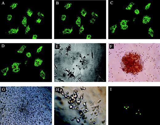 Figure 2. Morphology of the cells in the End or Methocult GF+ media and their immunofluorescence staining patterns. (A) The induced cells expressed high levels of CD31 (green; original magnification × 400). (B) The cells expressing high levels of CD31 could take up DiI-Ac-LDL, showing a punctate pattern of fluorescence (orange) characteristic of endothelial cells (original magnification × 400). (C) The induced cells expressed high levels of VWF (green; original magnification × 400). (D) The cells expressing high levels of VWF could take up DiI-Ac-LDL, showing a punctate pattern of fluorescence (orange) characteristic of endothelial cells (original magnification × 400). (E) The induced sibling cells from single-cell–derived clones on matrigel extended gradually to form a capillary-like structure on day 10 (original magnification × 100). The induced sibling cells formed BFU-Es (F, original magnification × 100), CFU-GMs (G, original magnification × 100), and CFU-Mk's (H, original magnification × 100). (I) FISH analysis of the induced cells, single red and green signal representing normal abl and bcr genes respectively, and the yellow signal representing fusion of abl and bcr genes (original magnification, × 1000). For panels A-D, a 40×/0.65 objective lens was used; for panels E-H, a 10×/0.25 objective lens was used; and for panel I, a 100×/1.25 objective lens was used.