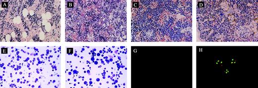 Figure 4. Morphologic analysis of murine BM and spleen engrafted with CML cells. (A) Histologic section of tibia of NOD/SCID mouse irradiated but not infused with human cells at day 62 (original magnification × 400). (B) Histologic section of tibia of mouse with human cells detectable at day 62. Hypercellular marrow with proliferation of megakaryocytes is shown (original magnification × 400). (C) Histologic section of spleen from control mouse showing monomorphic lymphoid population (original magnification × 400). (D) Histologic section of spleen of mouse with human cells detectable at day 62. Infiltration with megakaryocytes is shown (original magnification, ×400). (E) Cytospin preparation of bone marrow from control mouse (original magnification × 400). (F) Cytospin preparation of bone marrow of mouse with human cells detected at day 62 showing prominent myeloid cells (original magnification × 400). (G) Cells detected by FISH with dual probes for bcr and abl showing no signal in cells from the bone marrow of control mouse (original magnification × 1000). (H) Differential engraftment of normal and leukemic CML cells in NOD/SCID mice detected by dual probes for bcr and abl genes. Normal cells show 2 red abl signals and 2 green bcr signals. Leukemic cells show a single red and green signal representing normal abl and bcr genes and the yellow signal representing fusion of abl and bcr genes (original magnification × 1000). The magnifications/numerical apertures of the objective lenses used were as follows: for panels A-F, 40×/0.65; for panels G-H, 100×/1.25.