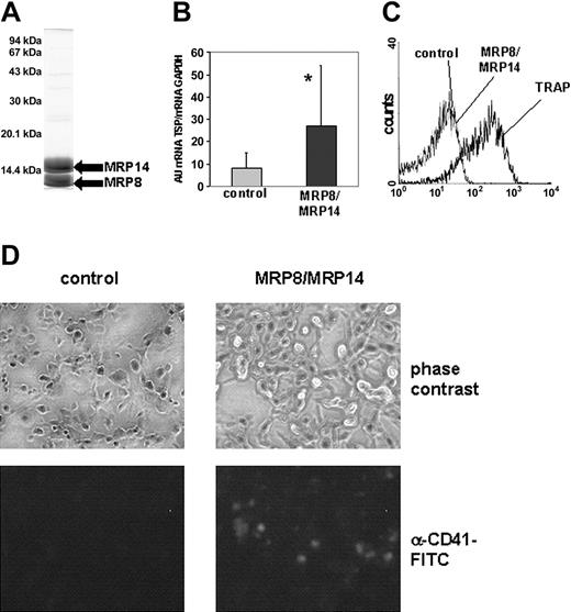 Figure 1. Thrombogenic effect of MRP8/MRP14. (A) After purification of MRP8 and MRP14 from human granulocytes, a sample containing 25 μg purified protein was separated on a 15% SDS gel. (B) In 4 independent experiments, the amount of TSP-1 transcription in control (▦) and MRP8/MRP14-treated HMECs (▪) was determined by quantitative RT-PCR and set in relation to GAPDH expression. Columns represent mean ± SD (*P < .005). (C) Isolated platelets were stimulated with TRAP (25 μM) and MRP8/MRP14 (200 μg/mL) or were kept in control medium. Binding of FITC-conjugated fibrinogen to platelets was analyzed by flow cytometry. (D) HMEC monolayers were incubated with whole blood under defined shear stress and were assessed for platelet binding. Platelets were identified by specific staining with an FITC-coupled anti-CD41 mAb but could also be visualized on monolayers by phase-contrast microscopy (magnification/numerical aperture of the objective lenses were 20/0.5).