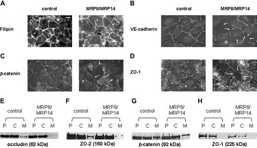 Figure 4. Loss of monolayer integrity and cell junction proteins after MRP8/MRP14 treatment. HMEC monolayers were cultured on coverslips and were treated for 16 hours with MRP8/MRP14 or control medium. Immunofluorescence staining was performed for membranous structures with filipin (A) and for VE-cadherin (B), β-catenin (C), and ZO-1 (D). Loss of cell junction proteins and substantial holes are indicated by arrows (A-D). Scale bar, 10 μm. Occludin (E), ZO-2 (F), β-catenin (G), and ZO-1 (H) were analyzed in postnuclear supernatants (P), cytosol (C), and membrane (M) fractions of whole cell lysates of MRP8/MRP14-treated and control HMECs by immunoblotting of equal amounts of protein.