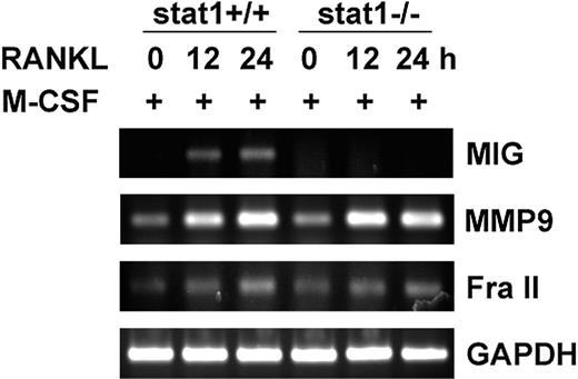 Figure 5. Lack of MIG induction by RANKL in STAT1-deficient osteoclast precursors. Osteoclast precursors from wild-type and STAT1-deficient mice were stimulated with 50 ng/mL M-CSF plus 100 ng/mL RANKL for the indicated time. RT-PCR was performed with isolated RNA using primers specific for each of MIG, MMP-9, Fra II, and GAPDH. RT-PCR products were separated on a 1.2% agarose gel and were stained with ethidium bromide.