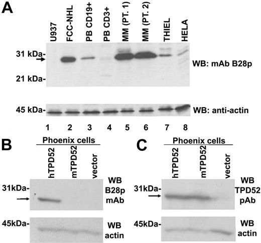 Figure 2. Western blotting of various primary samples and cell lines. (A) The B28p mAb recognizes a 28-kDa protein expressed in B cells and plasma cells. B28p identifies a band of approximately 28 kDa (arrow) in a Western blot of lysates from the NHL-FCC patient sample (lane 2), peripheral blood (PB) purified B cells (lane 3), 2 multiple myeloma (MM) patients (lanes 5 and 6), the Thiel myeloma cell line (lane 7), and the HeLa cell line (lane 8). The 28-kDa band was undetectable in the U937 cell line (lane 1) and barely detectable in normal T cells purified from peripheral blood (lane 4). Similar amounts of total protein lysates were loaded in each lane (see antiactin Western blot, bottom). None of the samples showed IRTA1 expression at immunohistochemical and Western blot analyses using the M-IRTA1 mAb (not shown). (B-C) B28p mAb and an anti-TPD52 polyclonal antibody recognize the same band of about 28 kDa in TPD52-transfected Phoenix cells. A band (arrow) of the expected molecular weight of TPD52 (about 28 kDa) is selectively detected by the B28 mAb (A) in cells transfected with human TPD52 (hTPD52) but not in cells transfected with murine TPD52 (mTPD52) or with the empty vector. A rabbit polyclonal antibody (here abbreviated as TPD52 pAb), known to recognize both hTPD52 and mTPD52, detects (C) the same band of about 28 kDa (arrow) in cells transfected with hTPD52 or with mTPD52 but not in cells transfected with the empty vector. An antiactin Western blot is shown as loading control in the bottom part of the 2 panels.