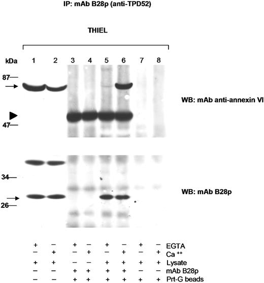 Figure 4. Ca2+-dependent coimmunoprecipitation of annexin VI with TPD52 in the Thiel myeloma cell line. Following immunoprecipitation (IP) with mAb B28p and protein G–Sepharose beads (Prt-G), proteins were analyzed by immunoblotting with murine mAbs against TPD52 (B28p, bottom panel) and annexin VI (top panel; bands in lanes 3-6 indicated by the arrowhead correspond to the heavy chains of the murine mAb B28p, detected by the secondary antimouse antibody). Coimmunoprecipitation of annexin VI (arrow in top panel) with TPD52 (arrow in bottom panel) was dependent on the presence of Ca2+ in the lysate (compare lanes 5 and 6).
