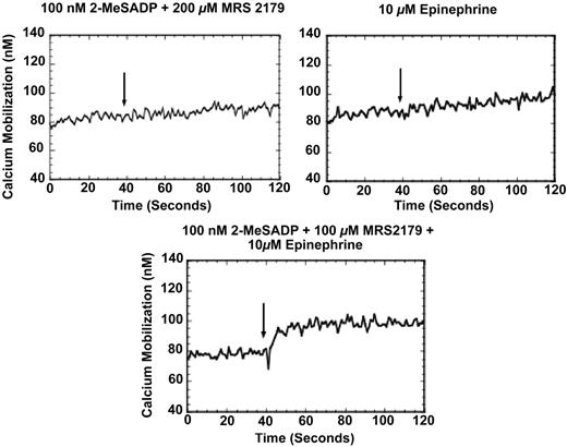 Figure 2. Intracellular calcium mobilization in response to simultaneous stimulation of the Gi and Gz signaling. Fura-loaded, aspirinated, washed human platelets were stimulated as noted under stirring conditions at 37°C. Where noted, the antagonist 200 μM MRS2179 was added 1 minute prior to the addition of other agonists. Arrows indicate addition of agonist. Tracings are representative of results obtained from 3 different donors.