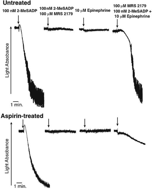 Figure 6. The effect of aspirin on platelet aggregation caused by simultaneous stimulation of the Gi and Gz pathways. Top panel contains aggregation tracings of non–aspirin-treated washed human platelets, while the bottom panel contains aspirin-treated washed human platelets. Where noted, the antagonist 100 μM MRS2179 was added 1 minute prior to the addition of other agonists. The agonists 100 nM 2-MeSADP and 10 μM epinephrine were added simultaneously where noted. The arrows indicate addition of agonists. All samples are performed in the presence of 1 mg/mL fibrinogen. Tracings are representative of data obtained from 3 different donors.