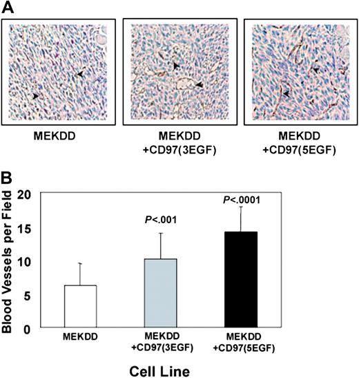 Figure 7. CD97 promotes angiogenesis in vivo. Subcutaneous tumors from MEKDD-parental, MEKDD-CD97/5EGF, and MEKDD-CD97/3EGF cells were generated and stained for endothelial cells as described in “Materials and methods.” (A) Representative fields of blood vessels stained with CD31 were photographed. Arrows indicate CD31-stained endothelial cells. Image acquisition was performed as described elsewhere.30 (B) Five ×32 microscopic fields were photographed and blood vessels more than 50 μm were counted. The results represent the mean of 5 fields for each of 4 tumors plus or minus SEM; n = 20; P values shown were determined by an unpaired t test comparing each CD97-expressing cell line to the parental.