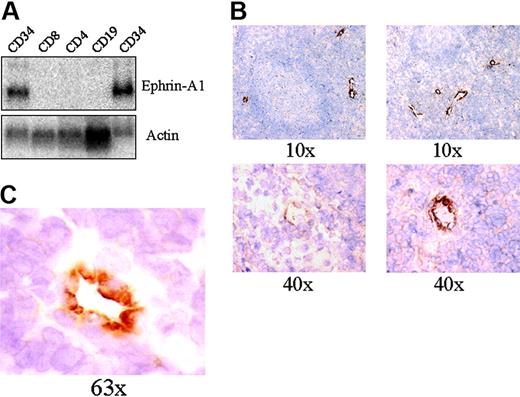 Figure 3. Ephrin-A1 is expressed on endothelial cells in tonsils. (A) Northern blot analysis of ephrin-A1 mRNA expression in selected cell populations isolated from tonsils. Two CD34+ cell isolations from 2 different tonsils are shown. Actin hybridization serves as a loading control. (B) Immunohistochemical analysis of ephrin-A1 expression in tonsils. Vessels, in particular HEVs, are stained (top panel left and right, bottom panel right). Anti-ephrin-A1 antibody from Santa Cruz Biotechnology. Original magnification is × 10 or × 40. (C) Immunohistochemical analysis of ephrin-A1 expression in tonsils. Bright staining is observed to the luminal side of HEV endothelial cells. Anti-ephrin-A1 antibody from Zymed. Original magnification is × 63.