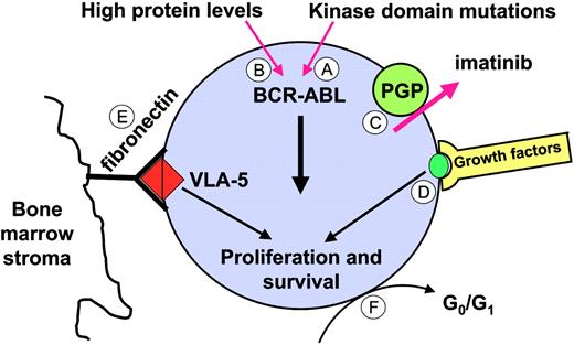 Figure 8. Potential mechanisms underlying disease persistence (molecular refractoriness). (A) Kinase domain mutations that confer moderate resistance to imatinib. (B) BCR-ABL levels may be particularly high in the most primitive leukemic stem cells. (C) Inadequate intracellular levels of imatinib as a result of PGP expression. (D) Physiologic growth factor signaling or (E) integrin signals may maintain viability even with BCR-ABL kinase activity completely inhibited. (F) Quiescent (dormant) cells may be protected against imatinib. VLA-5 indicates very late activation antigen-5.