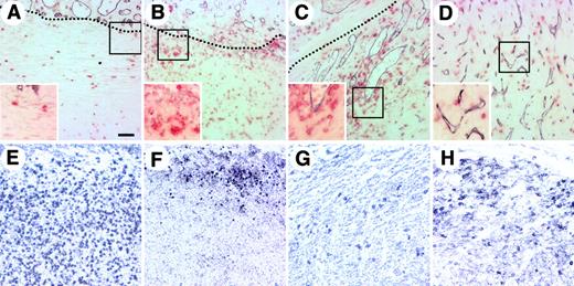 Figure 1. Localization of HCs in colon26 tumor tissues. (A-D) Sections of colon26 tumor tissues from tumors with a volume of (A) 30 to 40 mm3, (B) 60 to 70 mm3, (C) 100 and 120 mm3, and (D) more than 500 mm3 were stained with anti–PECAM-1 mAb (dark blue) and anti-CD45 mAb (red). The dotted line (A-C) shows the border between the fibrous cap surrounding the tumor mass and the tumor mass. The area beneath the dotted line is the tumor mass. (E-H) Sections from colon26 tumors of 60 to 70 mm3 that were stained with anti-CD11b (Mac-1) (E), anti-B220 (F), a mixture of anti-CD4 and anti-CD8 (G), or anti–Ly-76 (Ter119) (H) mAb. Insets in panels A-D show high-power views of the area indicated by box. Bar indicates 50 μm.